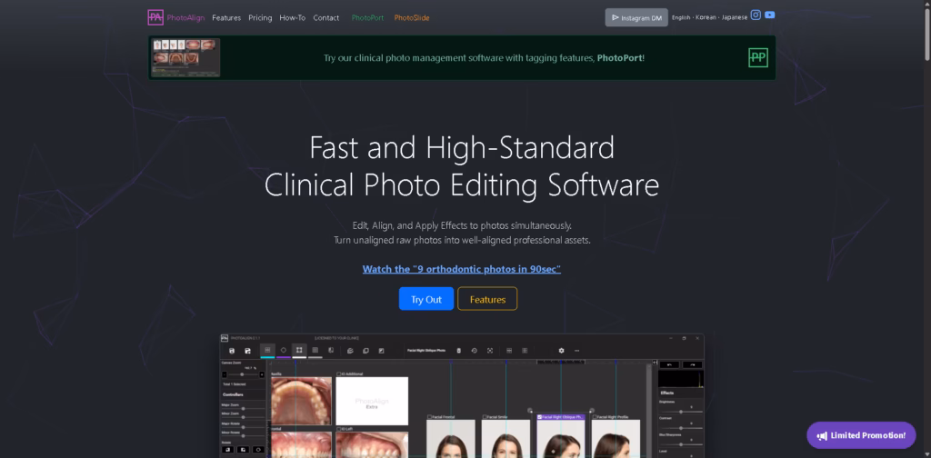 PhotoAlign -The-Best-Dental-Photo-Editor